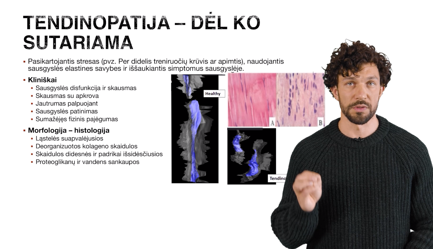 Kas yra tendinopatija