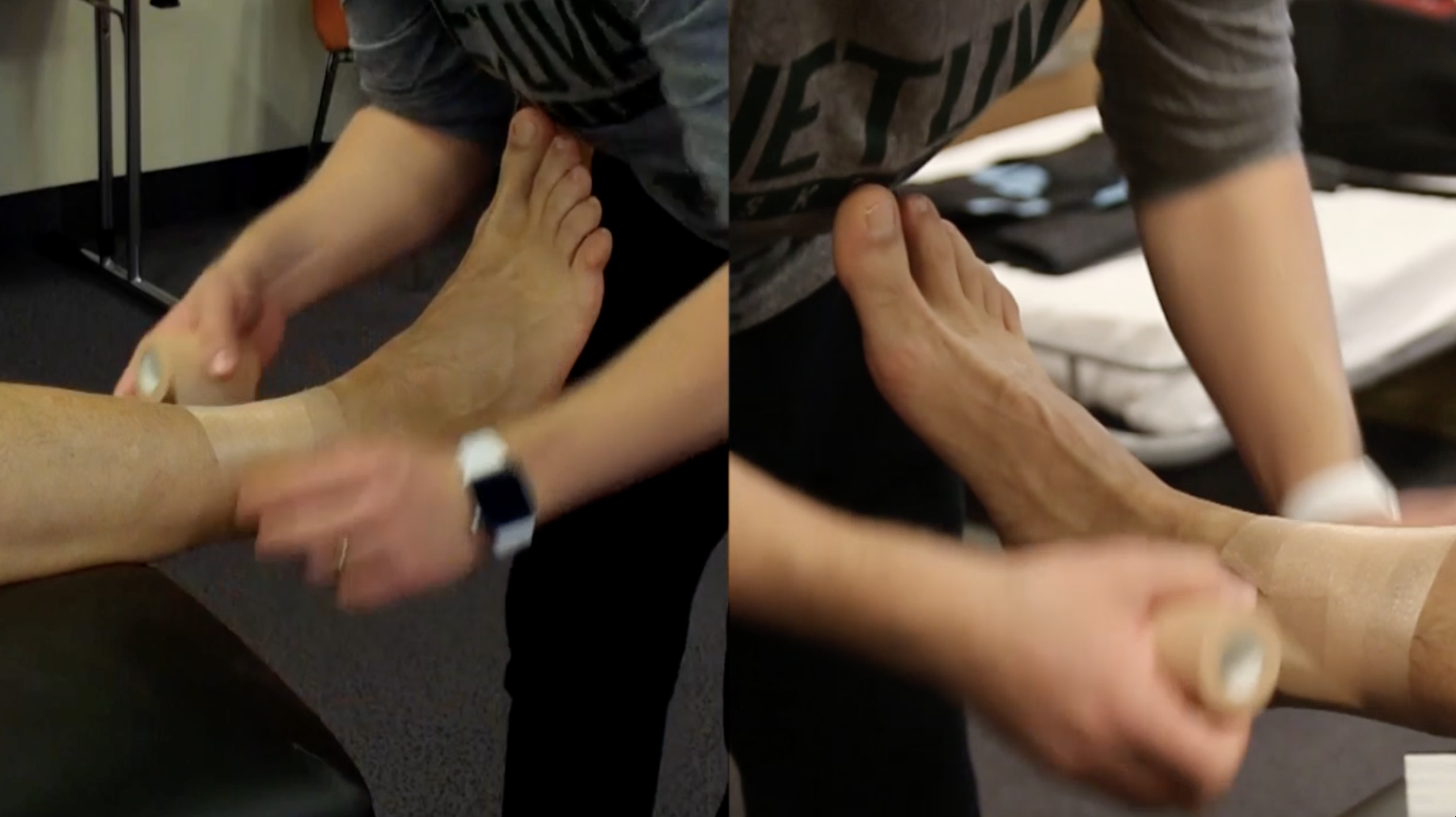 Achilo sausgyslės teipavimas