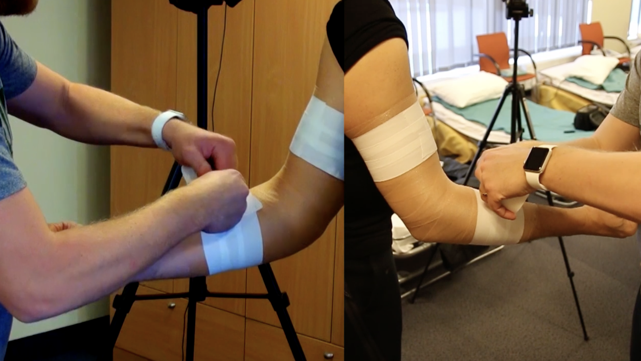 Alkunės sąnario teipavimas