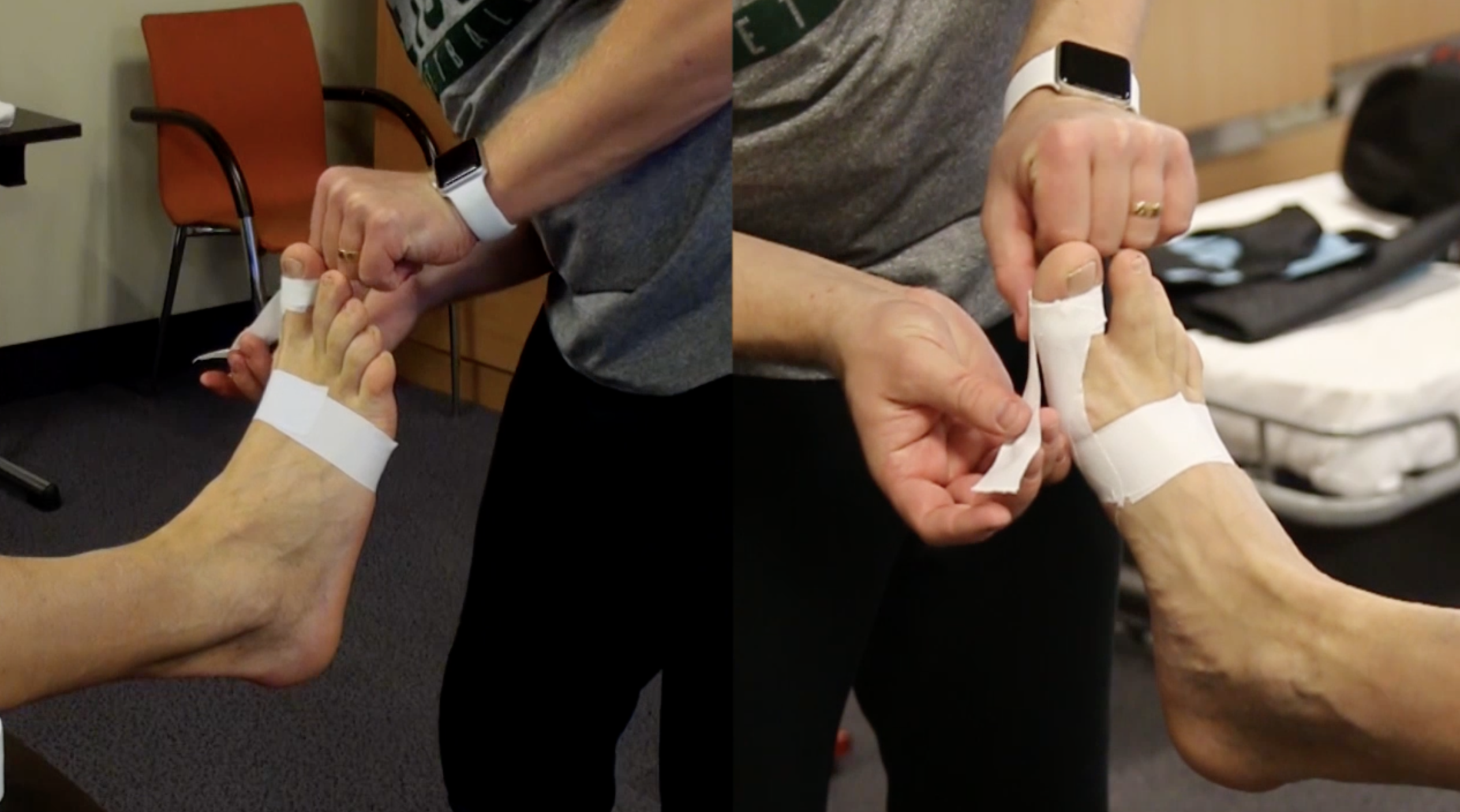 Čiunos teipavimas minkštu teipu