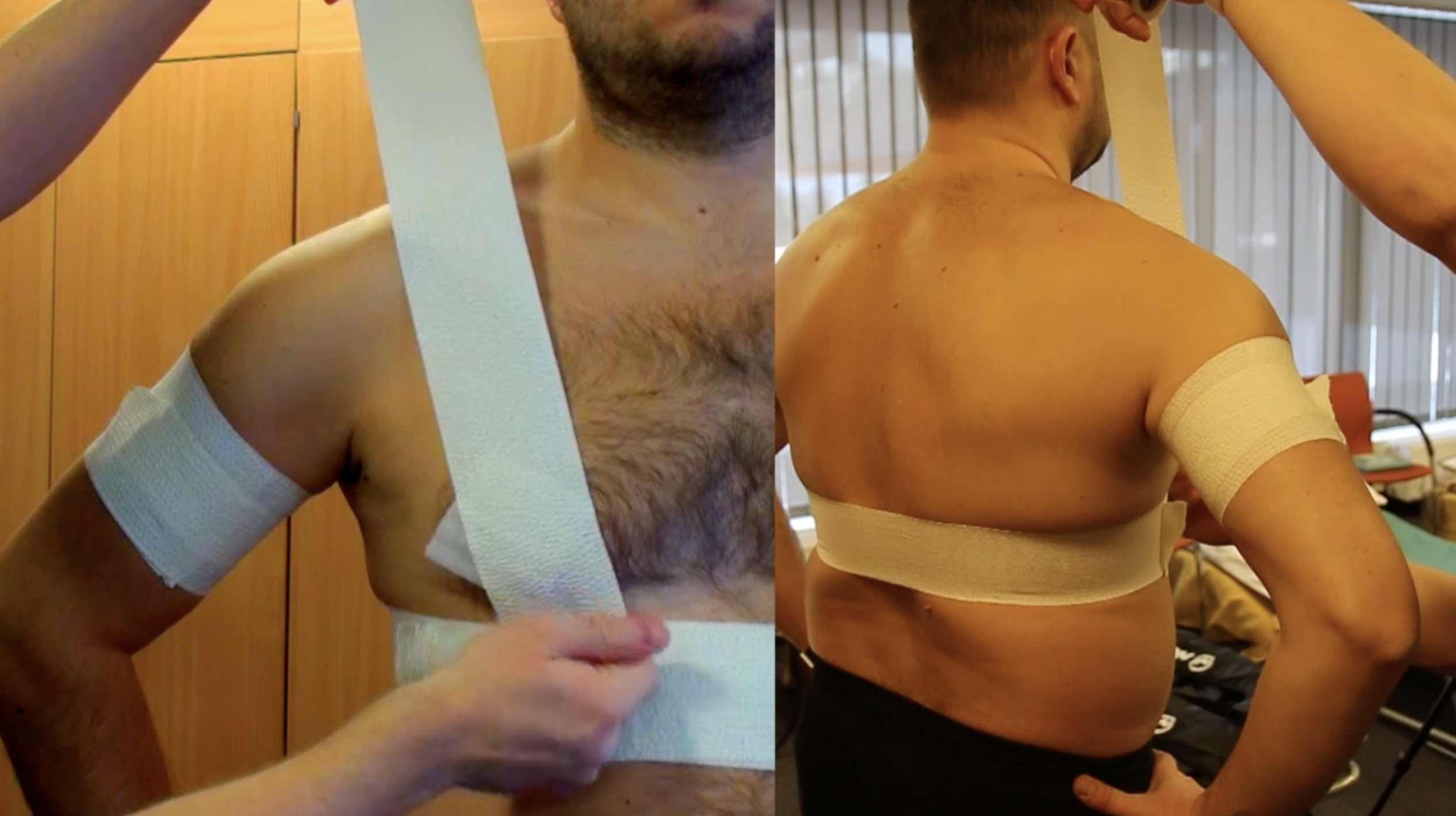 Peties sąnario teipavimas