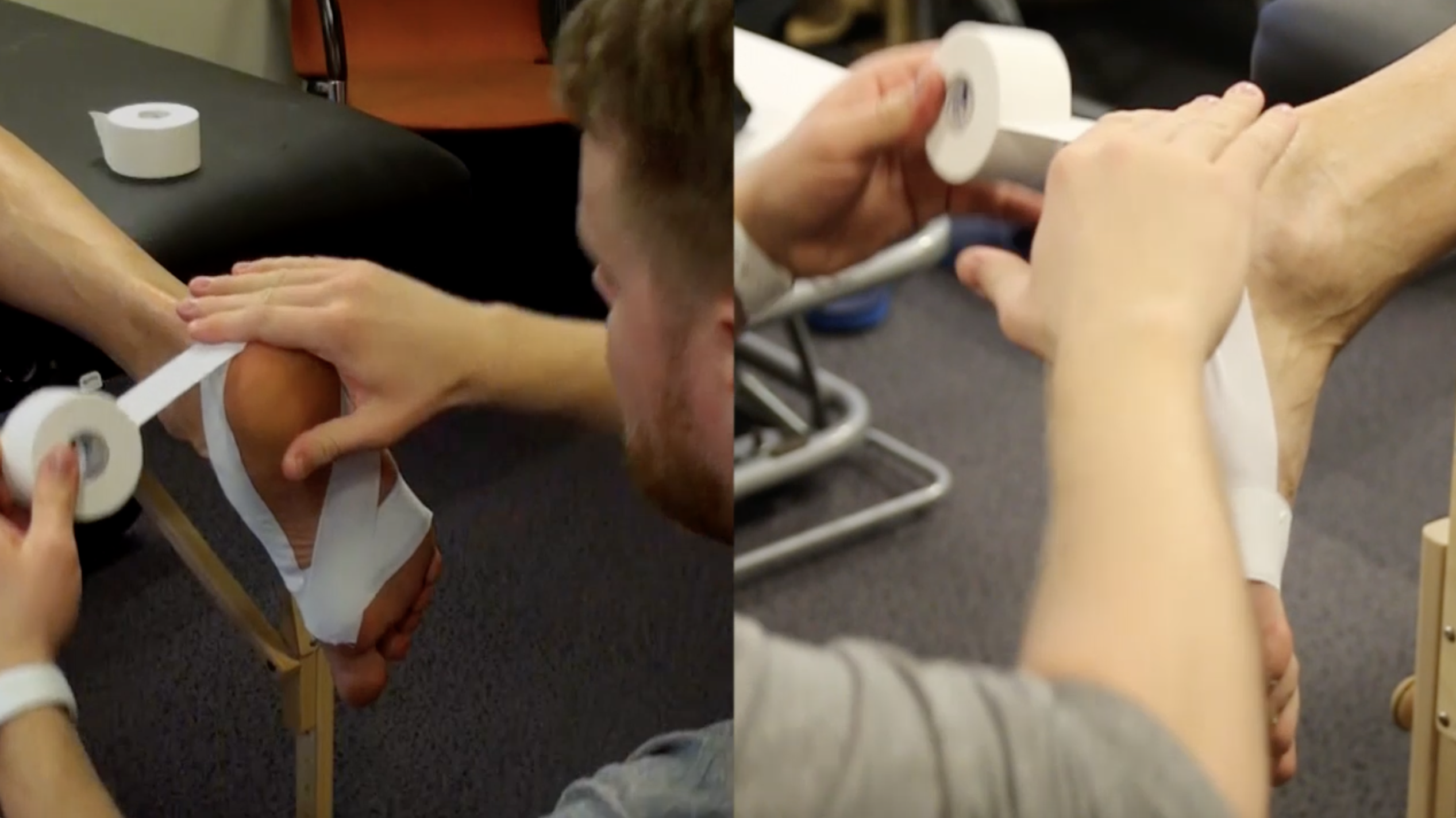 Plantalinės facijos teipavimas