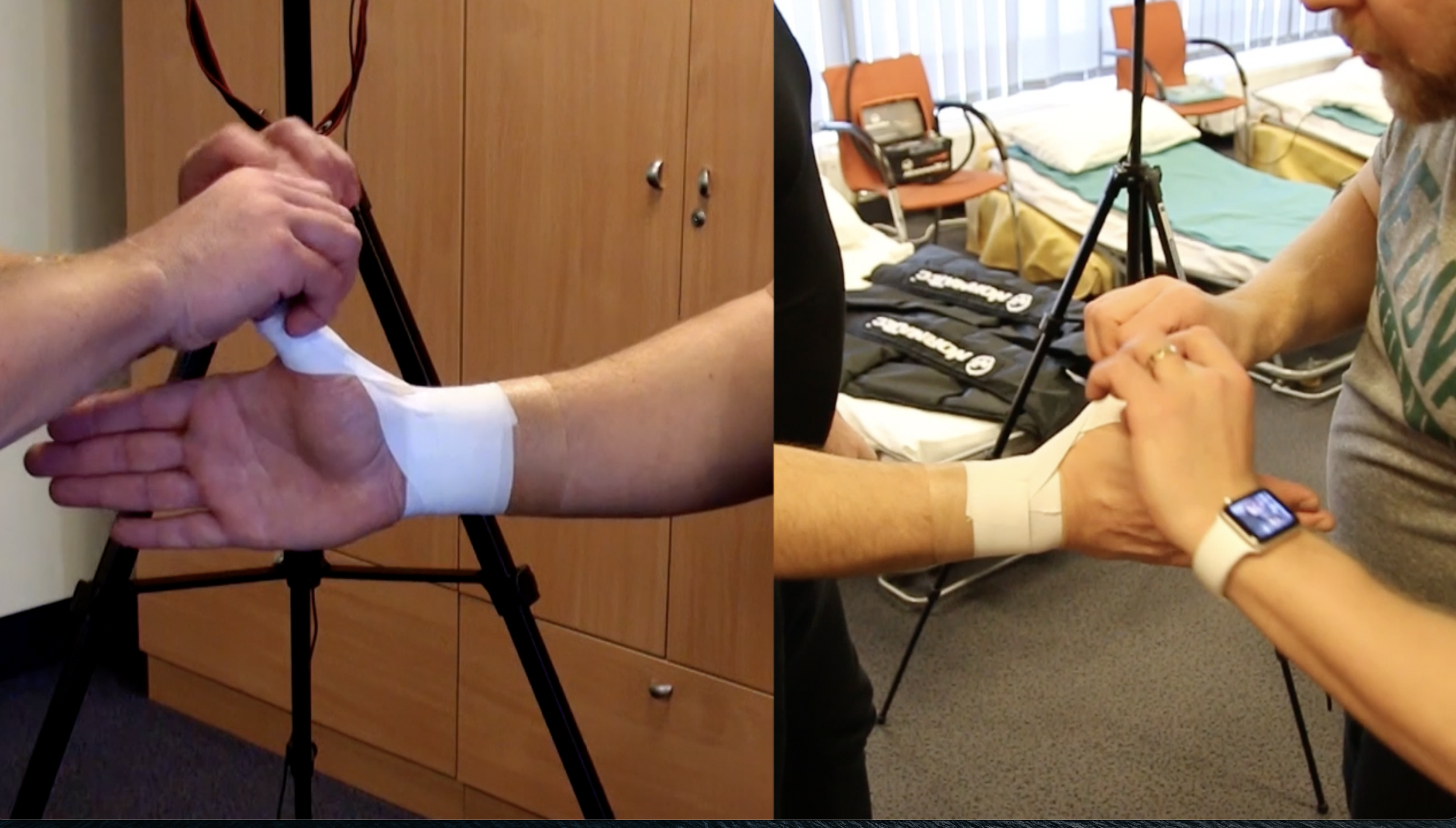 Proksimalinio rankos nykščio teipavimas