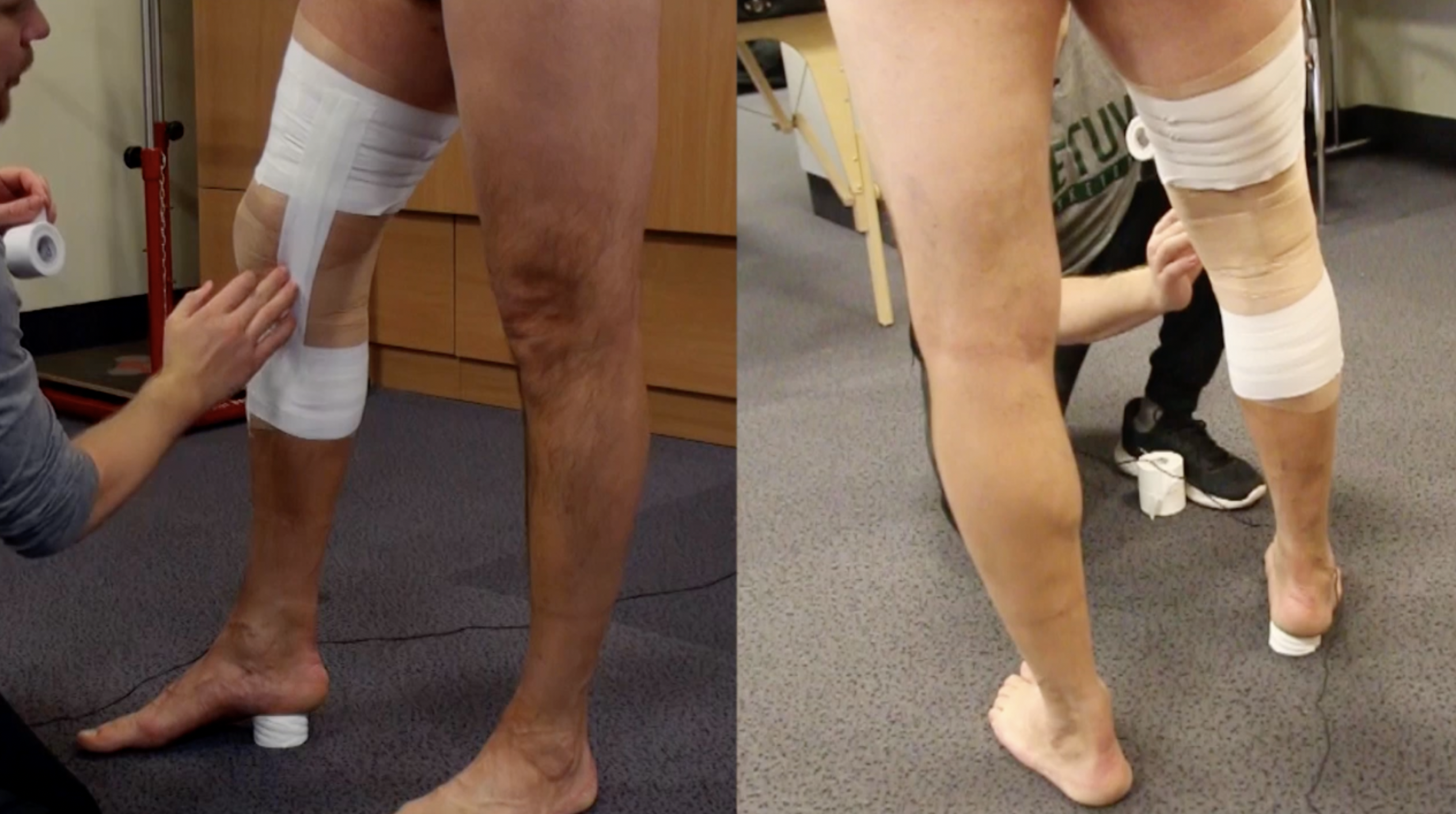 Kelio sąnario teipavimas